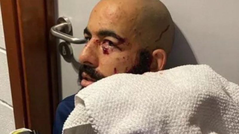 Goleiro do Bahia, Danilo Fernandes segue afastado após ataque que atingiu seu rosto